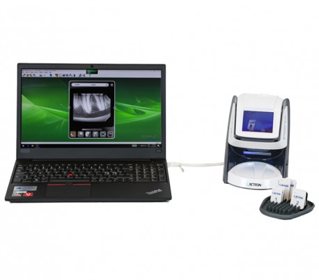 Acteon - PSPIX 2 Phosphor Plate Scanner