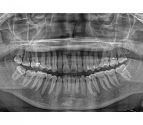 Trident - X-VIEW 2D PAN Panoramic X-ray System