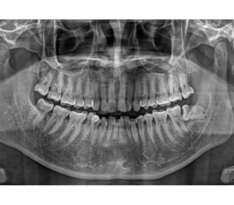 Trident - X-VIEW 2D PAN Panoramic X-ray System