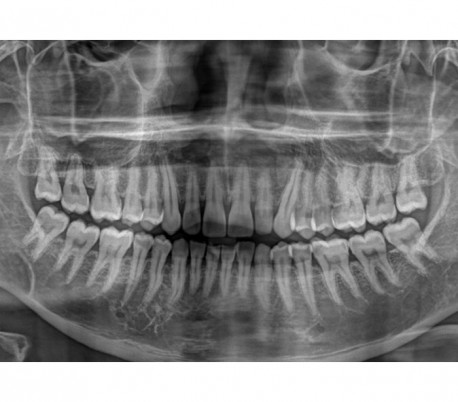 Trident - X-VIEW 2D PAN Panoramic X-ray System