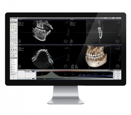 Trident - X-VIEW 3D PAN (OPG ) Panoramic X-ray System