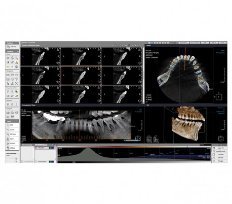 Trident - X-VIEW 3D PAN (OPG ) Panoramic X-ray System