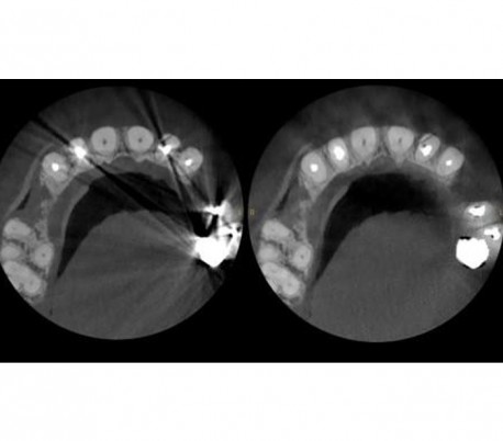 سی تی اسکن دندان (CBCT) مدل Carestream - CS9600