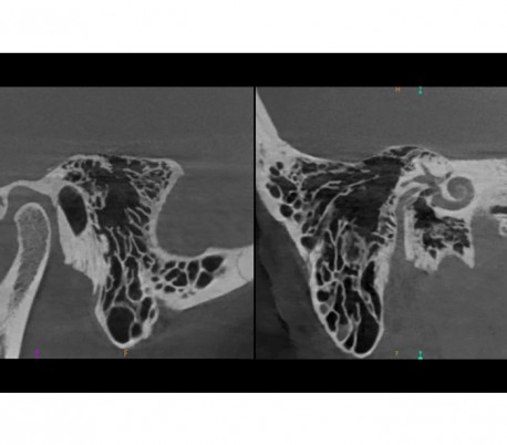 سی تی اسکن دندان (CBCT) مدل Carestream - CS9600