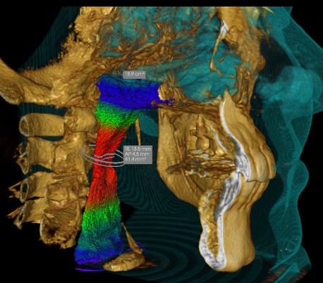 سی تی اسکن دندان (CBCT) مدل Carestream - CS9600