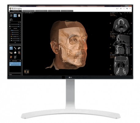 سی تی اسکن دندان (CBCT) مدل Carestream - CS9600