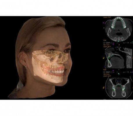 Carestream - CS9600 CBCT Scanner