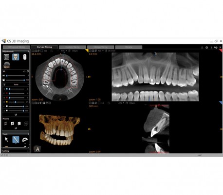 Carestream - CS8100 EVO 3D CBCT Scanner