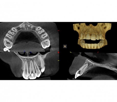 سی تی اسکن دندان (CBCT) مدل Carestream - CS8100 EVO 3D