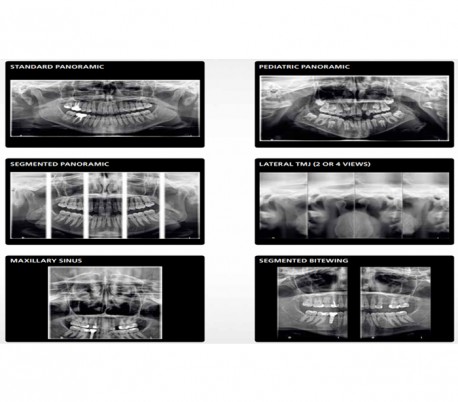 Carestream - CS8100 EVO 3D CBCT Scanner