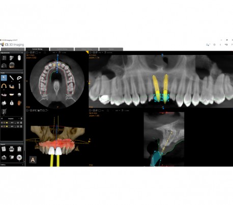 سی تی اسکن دندان (CBCT) مدل Carestream - CS8100 EVO 3D