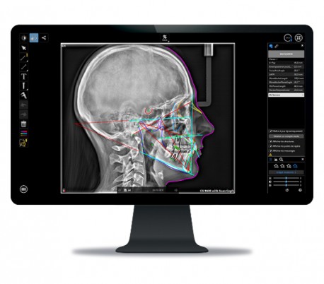 سی تی اسکن دندان (CBCT) مدل Carestream - CS8100 EVO 3D