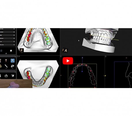 Carestream - CS8100 EVO 3D CBCT Scanner