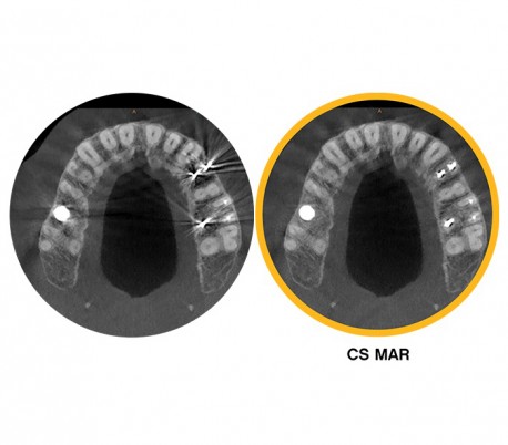 Carestream - CS8100 EVO 3D CBCT Scanner