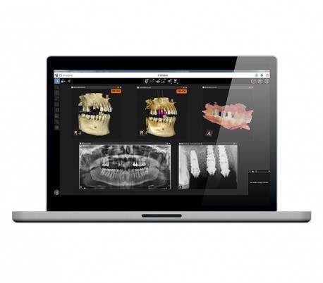 سی تی اسکن دندان (CBCT) مدل Carestream - CS8100 EVO 3D