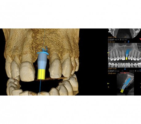 Carestream - CS8100 EVO 3D CBCT Scanner