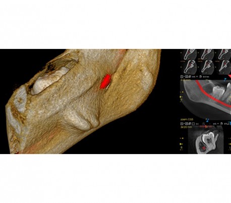 Carestream - CS8100 EVO 3D CBCT Scanner