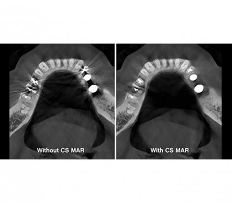 Carestream - CS 8200 3D CBCT Scanner