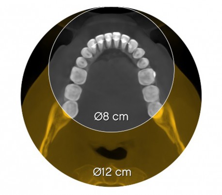 سی تی اسکن دندان (CBCT) مدل Carestream - CS8200 3D