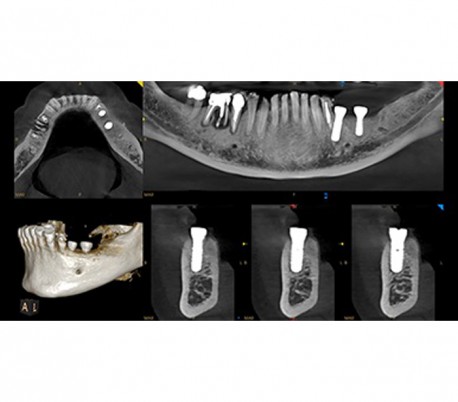 سی تی اسکن دندان (CBCT) مدل Carestream - CS8200 3D