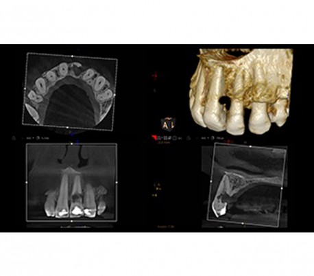 سی تی اسکن دندان (CBCT) مدل Carestream - CS8200 3D