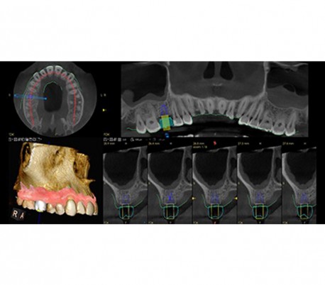 Carestream - CS 8200 3D CBCT Scanner