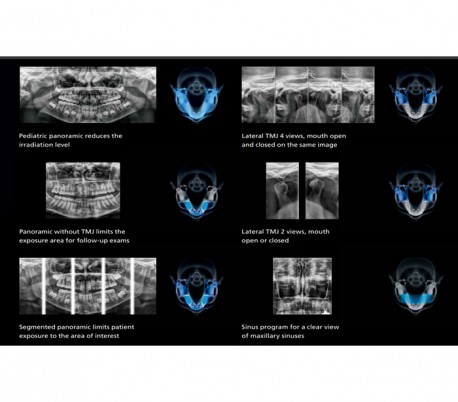 Carestream - CS8100 (OPG) Panoramic X-ray system