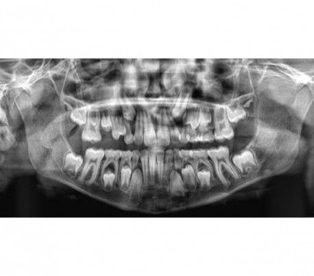 Carestream - CS8100 (OPG) Panoramic X-ray system