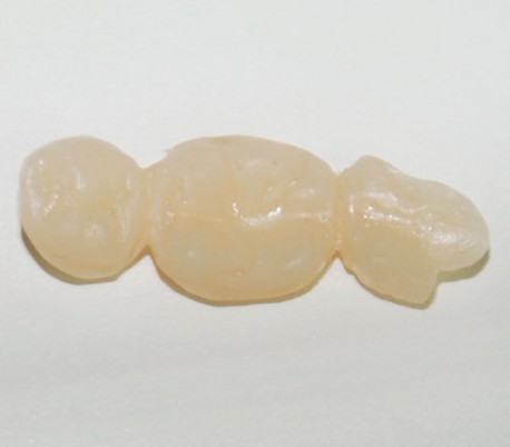 Elsodent - Phoenix MD Composite