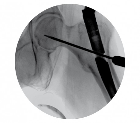 Simad - Mobile C- arm Moonray Compact Radiology Device