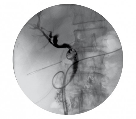 Simad - Mobile C- arm Moonray Compact Radiology Device