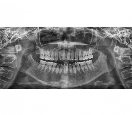 Genoray - Papaya 3D Plus (OPG) X-Ray Imaging System