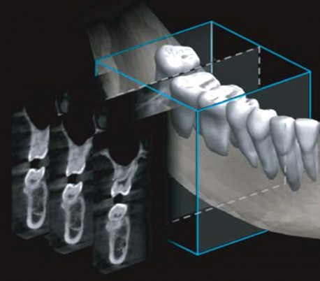 Genoray - Papaya Plus (OPG) X-Ray Imaging System