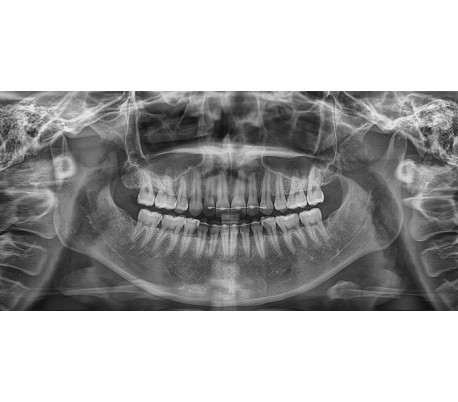 Genoray - Papaya Plus (OPG) X-Ray Imaging System