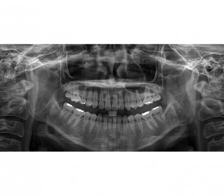 Genoray - Papaya Plus (OPG) X-Ray Imaging System