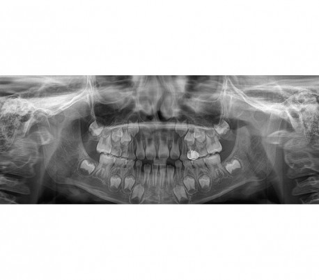 Genoray - Papaya Plus (OPG) X-Ray Imaging System