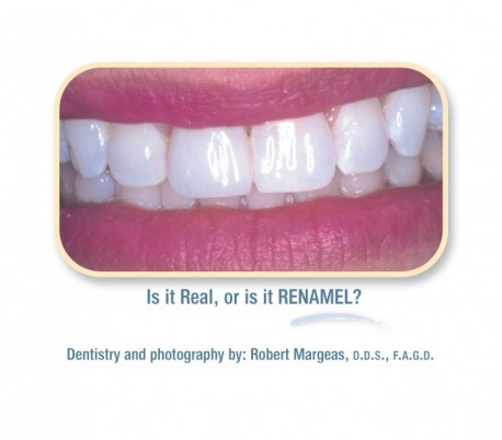 Cosmedent - Renamel Microfill (Enamel) SuperBrite Composite