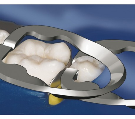 UltraDent - Omni-Matrix Sectional Clamp