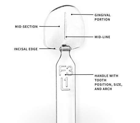 UltraDent - Uveneer Extra Kit