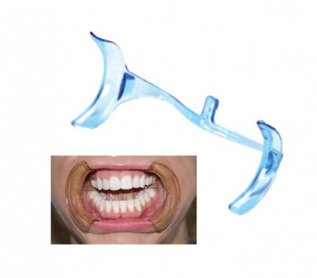 Saman Dandan - Intraoral Cheek Retractors with Tongue Guard