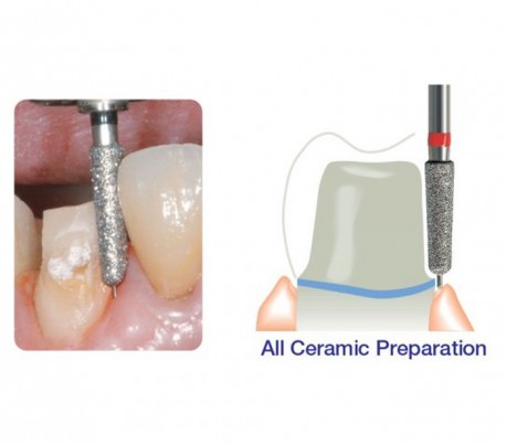 DiaTessin - Axial Pin Diamond Bur