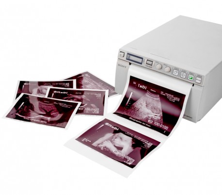 Tecnoscan - 110S Ultrasound Paper