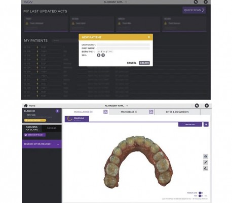 Biotech Dental - WOW Intraoral Scanner