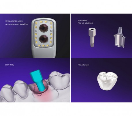 Biotech Dental - WOW Intraoral Scanner