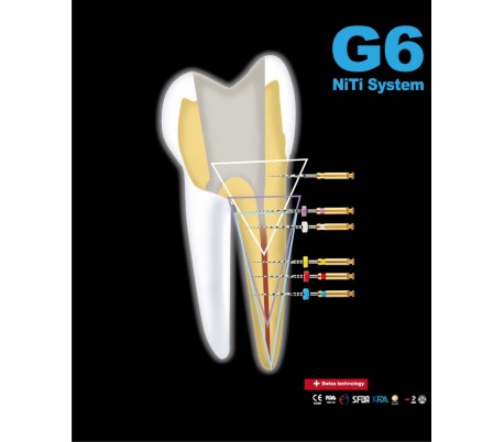 Global Top - G6 Protaper Rotary File