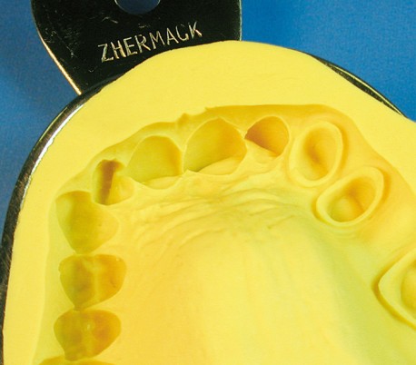 Zhermack - Orthoprint Alginate