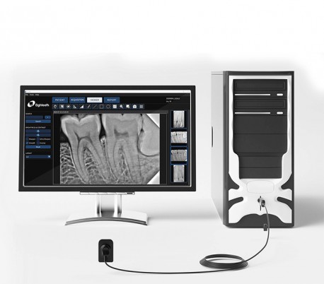 Eighteeth - NanoPix Digital X-Ray Sensor