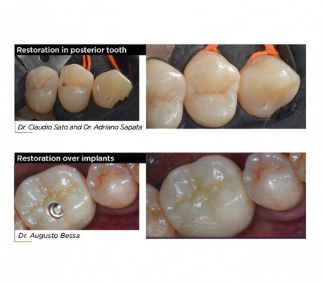 FGM - Vittra APS Unique Composite