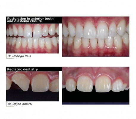 FGM - Vittra APS Unique Composite