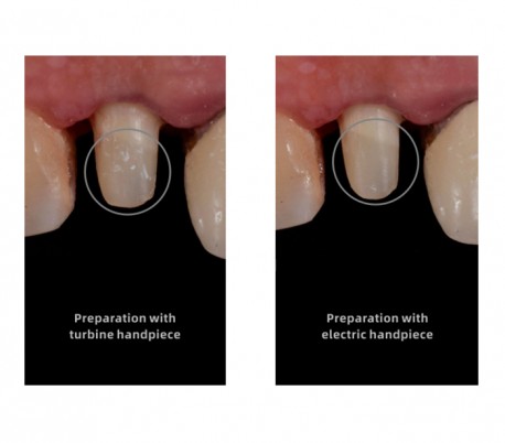 Woodpecker - MT2 Dental Electrical Motor